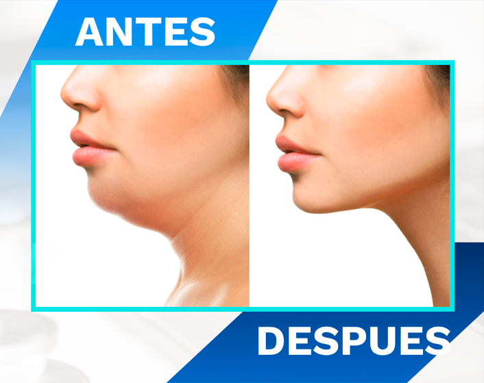 diseño sin título 2026 04 28t230726.576