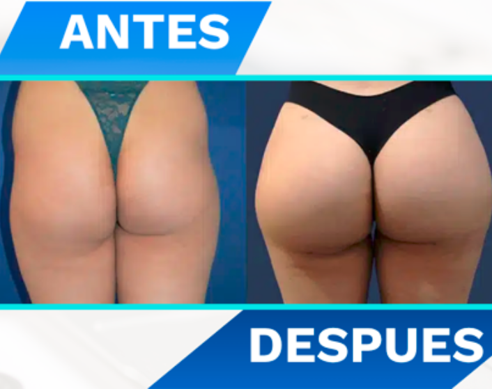 diseño sin título 2026 04 28t230812.089